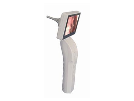 Otoscope